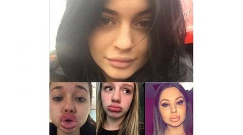 Cara Langkah Mendapatkan Bibir Tebal Indah Dengan Melakukan Kylie Jenner Challenge